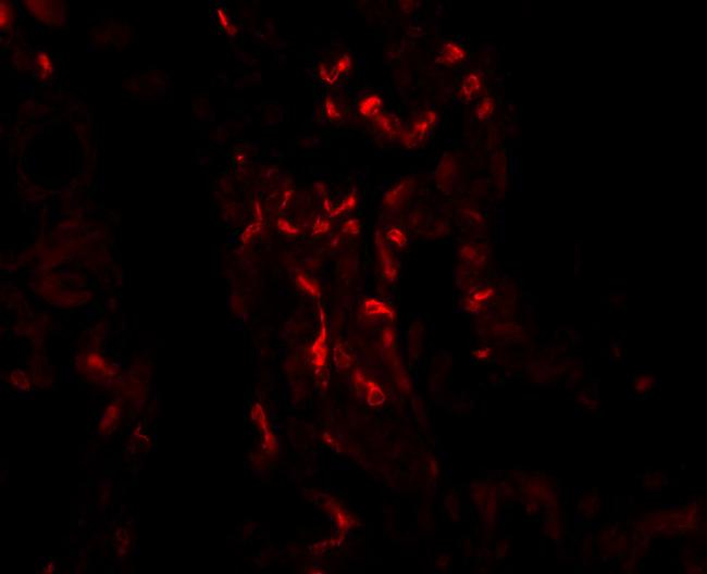 TNFAIP3 Antibody in Immunocytochemistry (ICC/IF)