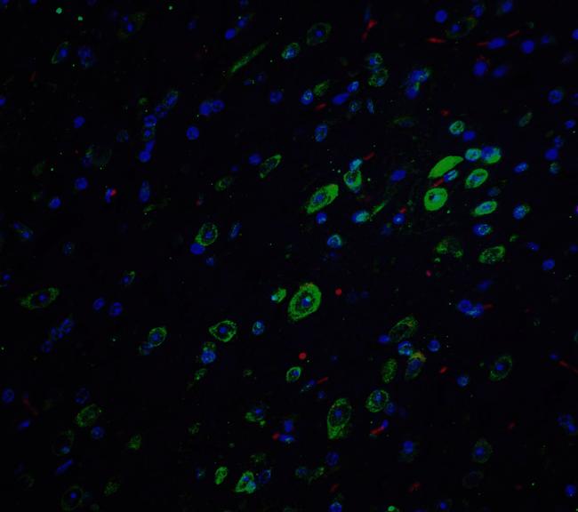 Amyloid Precursor Protein Antibody in Immunohistochemistry (IHC)