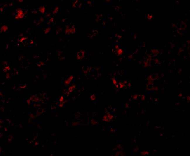 AP2M1 Antibody in Immunocytochemistry (ICC/IF)