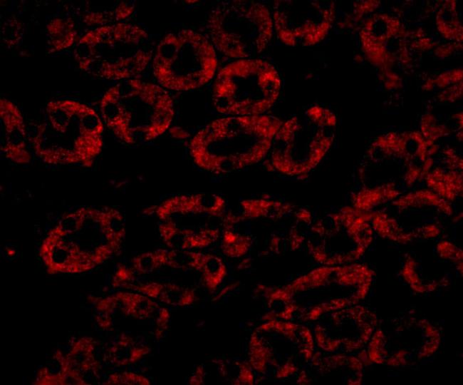 NPC1 Antibody in Immunocytochemistry (ICC/IF)