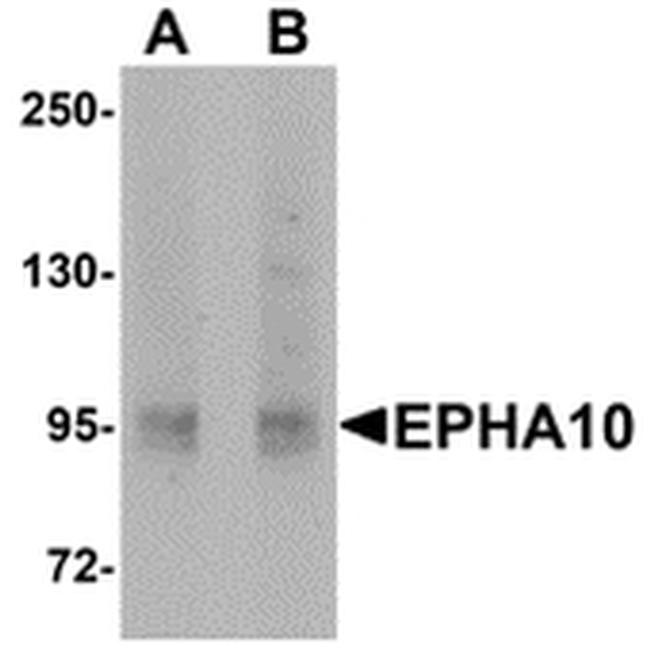 EphA10 Antibody in Western Blot (WB)