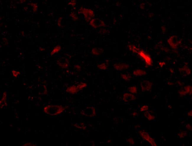 GALNT10 Antibody in Immunocytochemistry (ICC/IF)