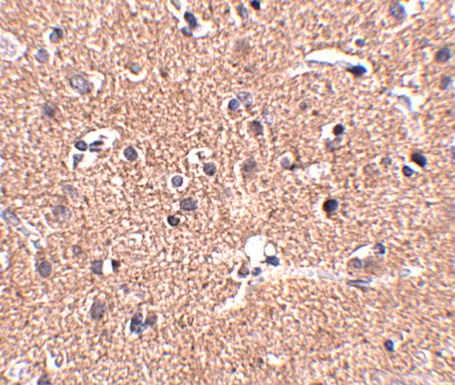 GALNT10 Antibody in Immunohistochemistry (IHC)