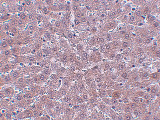 JMJD1B Antibody in Immunohistochemistry (IHC)