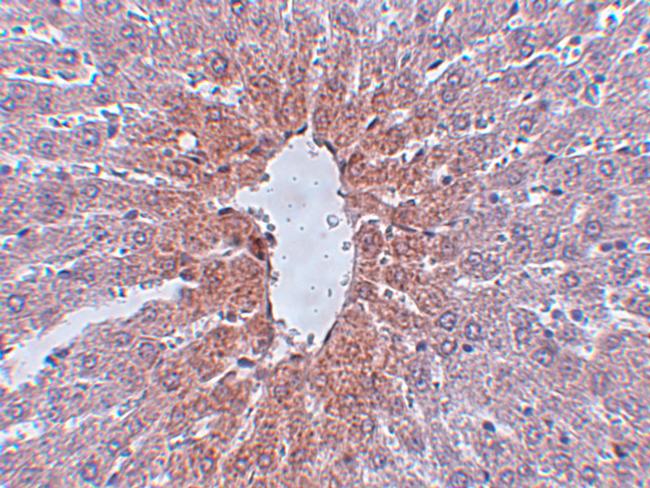 JMJD1C Antibody in Immunohistochemistry (IHC)