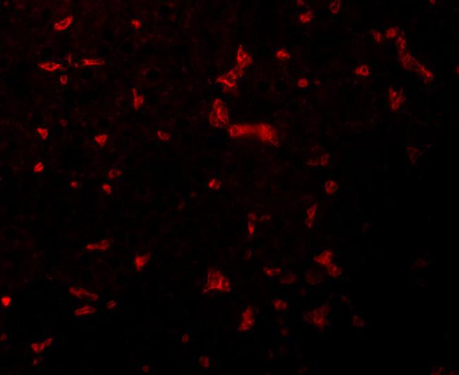 RIP1 Antibody in Immunocytochemistry (ICC/IF)