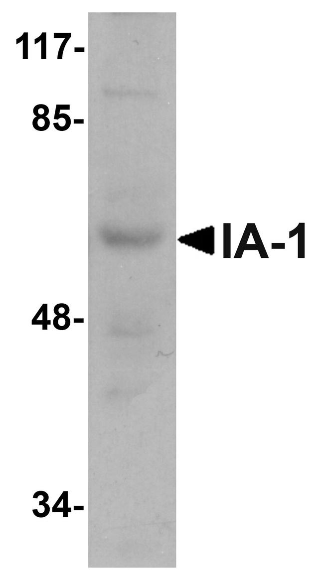 IA-1 Antibody in Western Blot (WB)