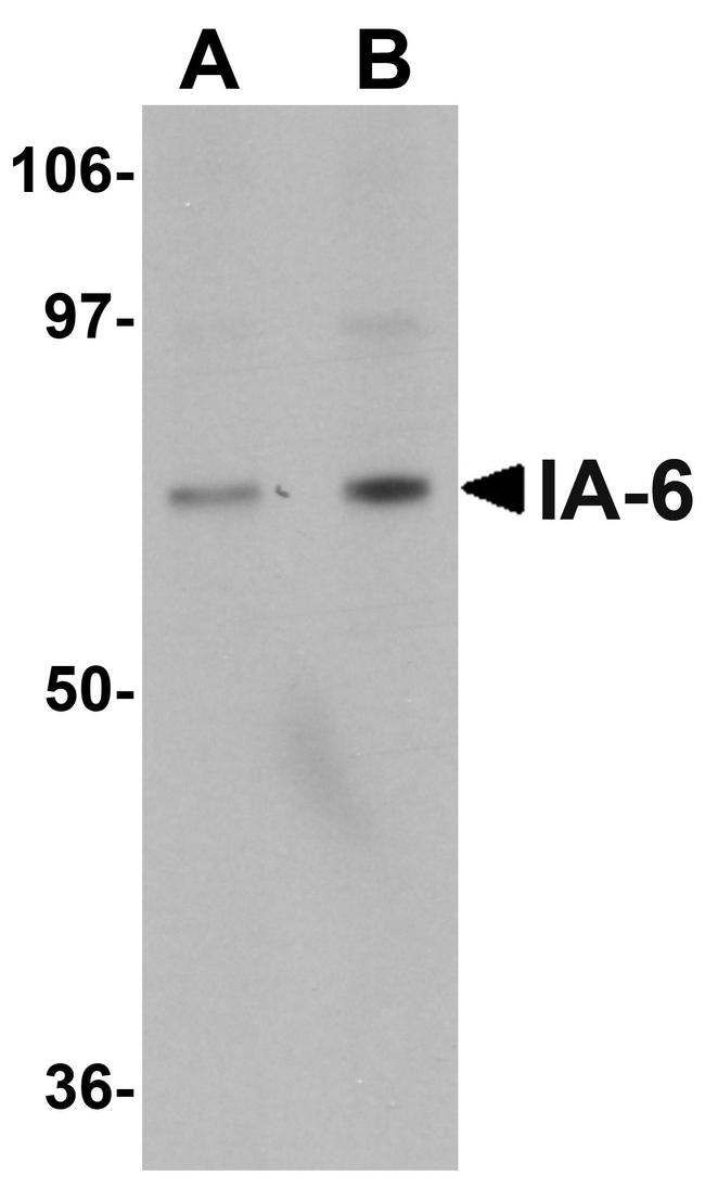 IA-6 Antibody in Western Blot (WB)