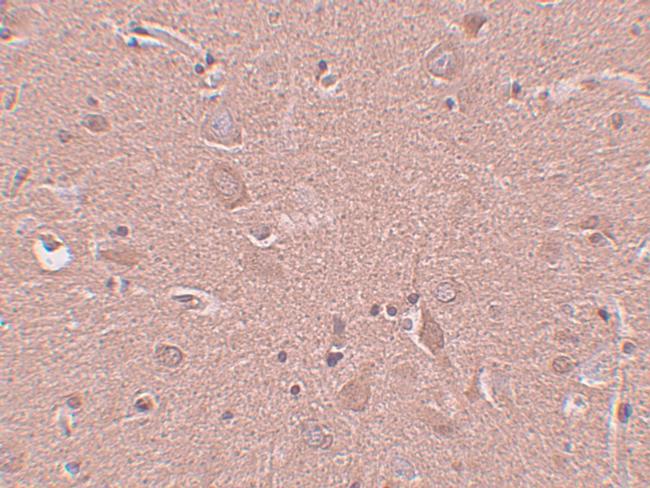 SRPX Antibody in Immunohistochemistry (IHC)