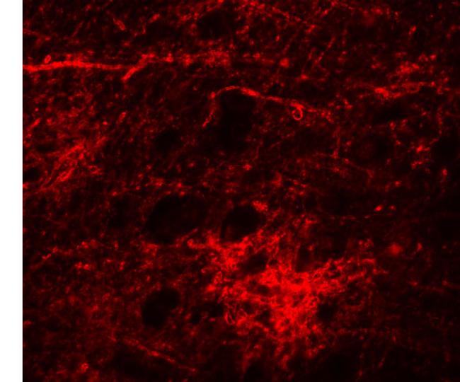 SIPA1L3 Antibody in Immunocytochemistry (ICC/IF)