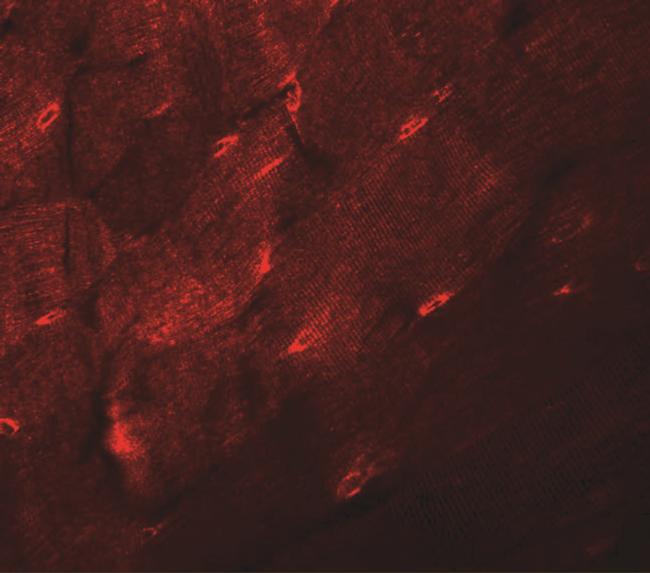 TMEM38A Antibody in Immunohistochemistry (IHC)