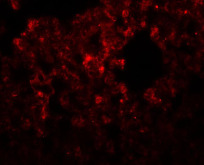 RHBDD3 Antibody in Immunohistochemistry (IHC)