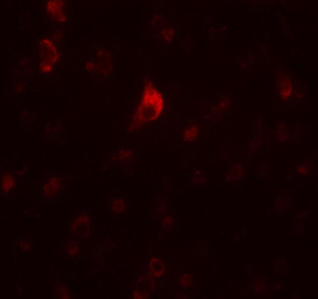 CALM Antibody in Immunohistochemistry (IHC)