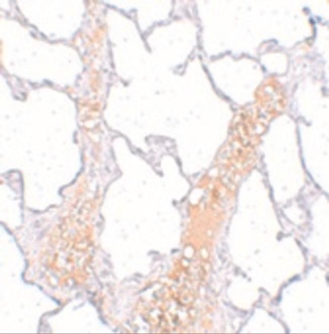 REEP2 Antibody in Immunohistochemistry (IHC)