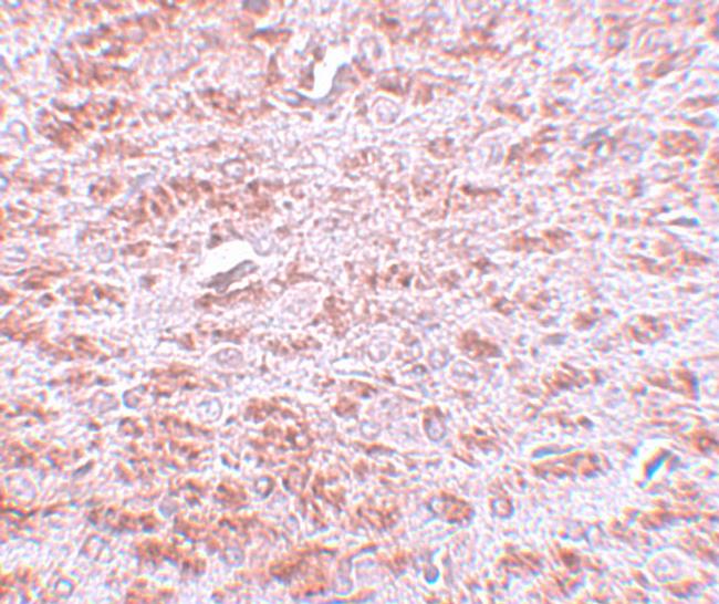 CDX2 Antibody in Immunohistochemistry (IHC)