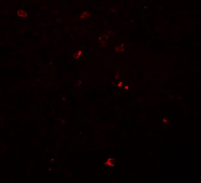 BCAS3 Antibody in Immunohistochemistry (IHC)