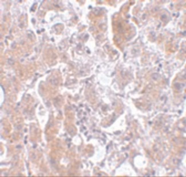 ELOVL7 Antibody in Immunohistochemistry (IHC)