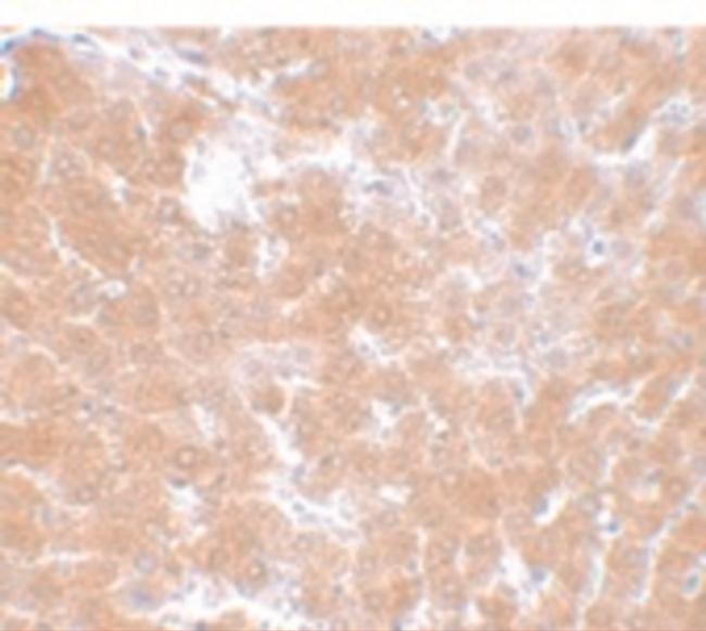 TMEM70 Antibody in Immunohistochemistry (IHC)