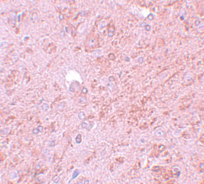 PIASy Antibody in Immunohistochemistry (IHC)