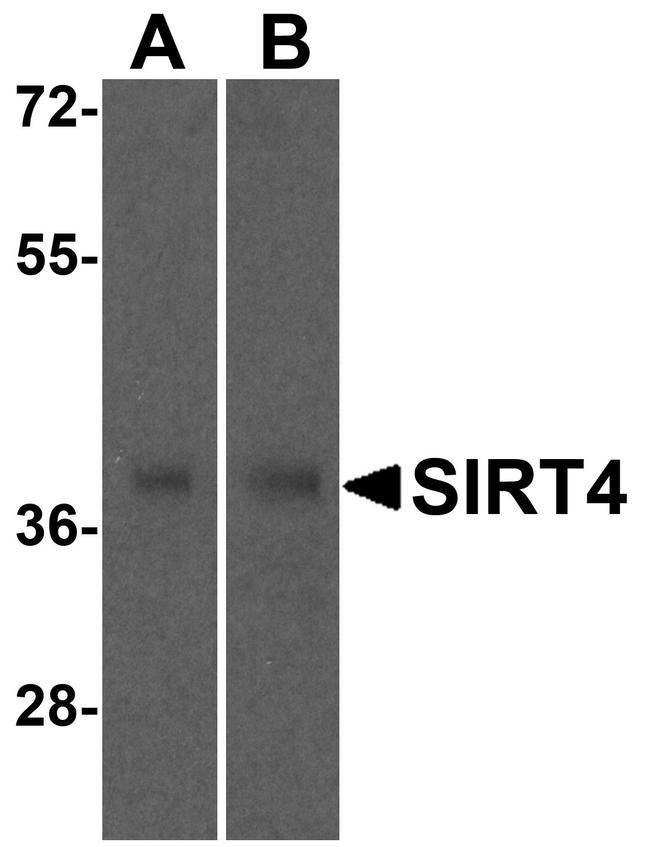 SIRT4 Antibody in Western Blot (WB)