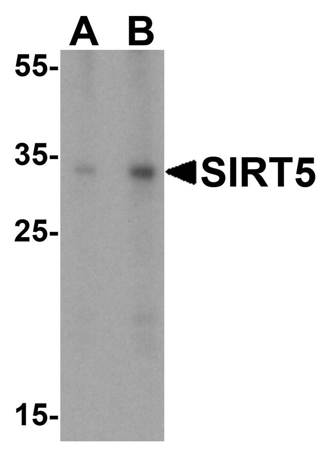 SIRT5 Antibody in Western Blot (WB)