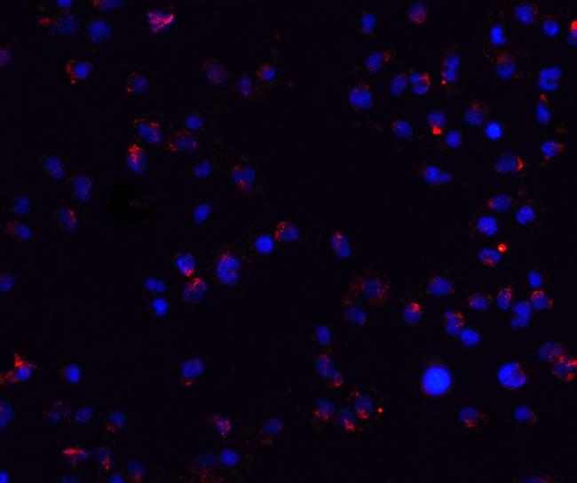 ZEB2 Antibody in Immunocytochemistry (ICC/IF)