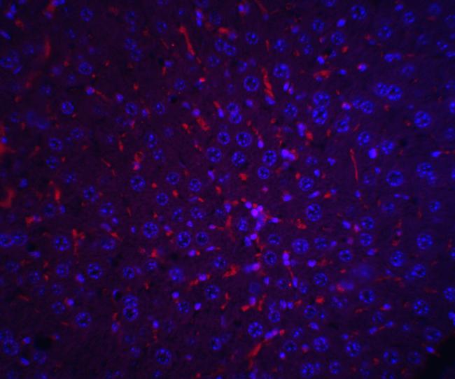 AFP Antibody in Immunohistochemistry (IHC)