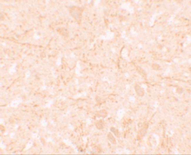 NALP12 Antibody in Immunohistochemistry (IHC)