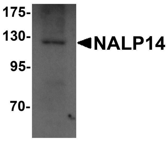 NALP14 Antibody in Western Blot (WB)