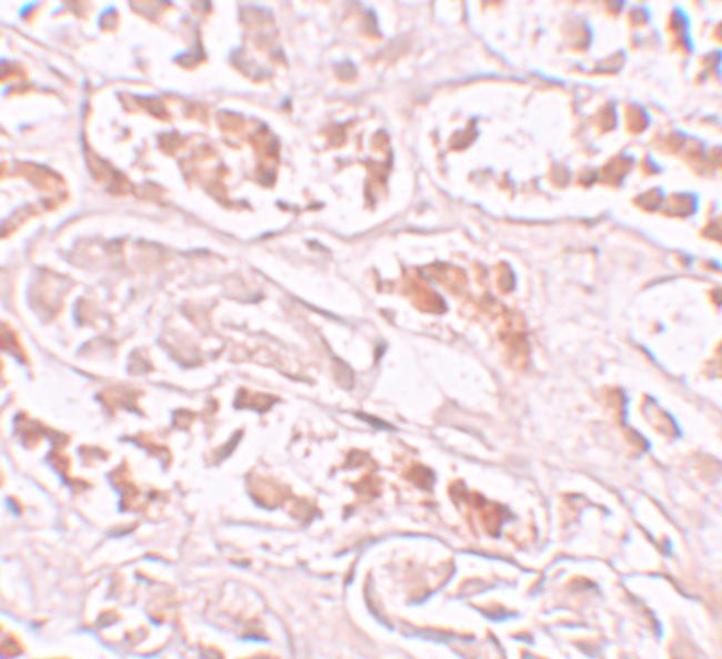 BANP Antibody in Immunohistochemistry (IHC)