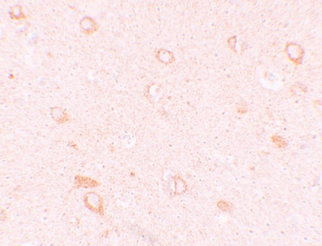 CIITA Antibody in Immunohistochemistry (IHC)