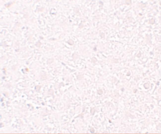 MOX1 Antibody in Immunohistochemistry (IHC)