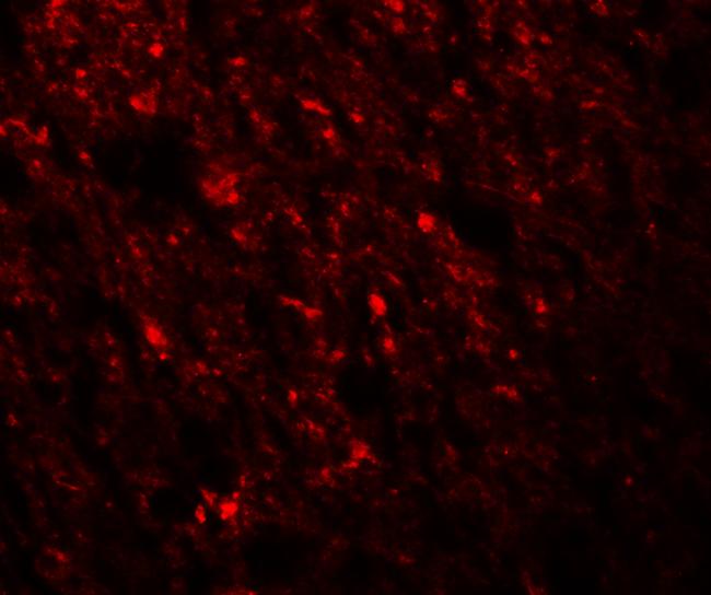 Staufen Antibody in Immunocytochemistry (ICC/IF)