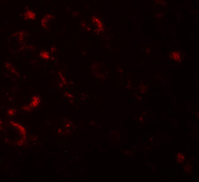 AXIN1 Antibody in Immunohistochemistry (IHC)