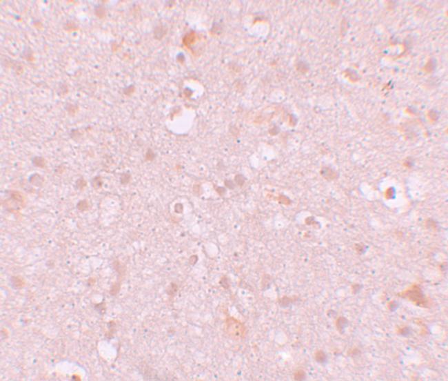 CXXC4 Antibody in Immunohistochemistry (IHC)