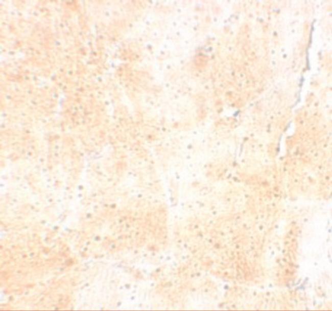 SYNPO2 Antibody in Immunohistochemistry (IHC)