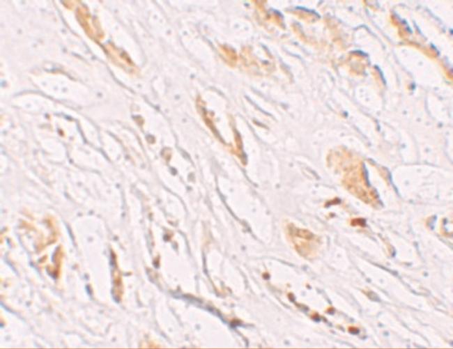 PEAR1 Antibody in Immunohistochemistry (IHC)