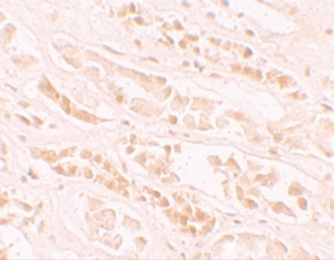 EFCAB4B Antibody in Immunohistochemistry (IHC)