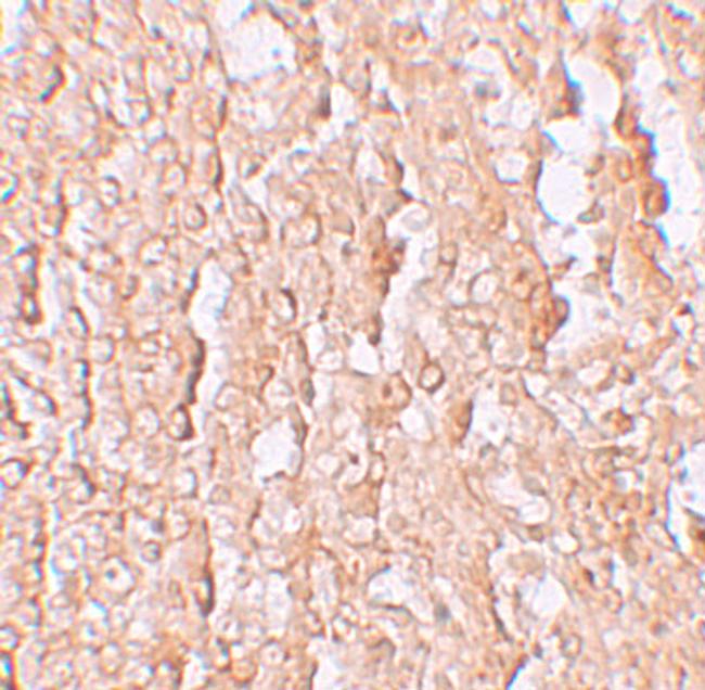 ZIP10 Antibody in Immunohistochemistry (IHC)