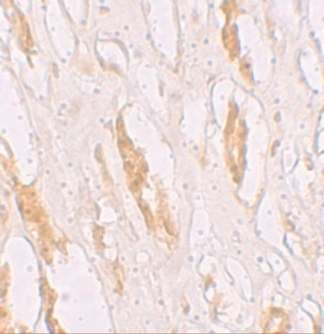 ZIP1 Antibody in Immunohistochemistry (IHC)