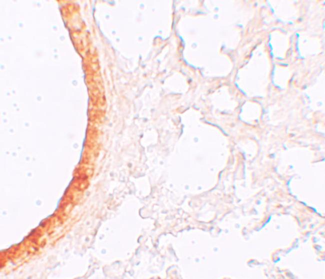 SLC39A3 Antibody in Immunohistochemistry (IHC)