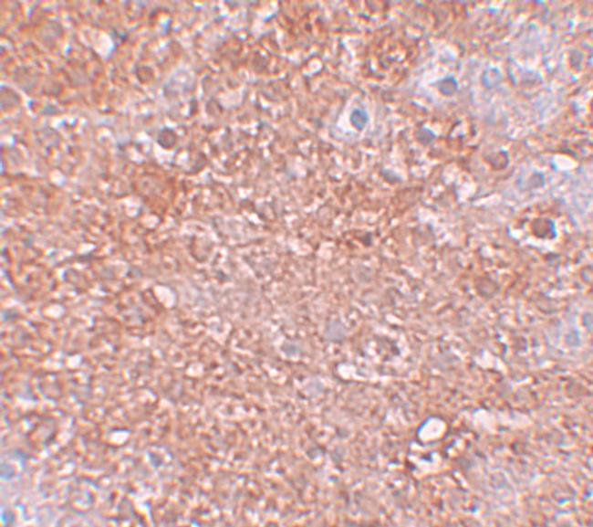 ZIP12 Antibody in Immunohistochemistry (IHC)