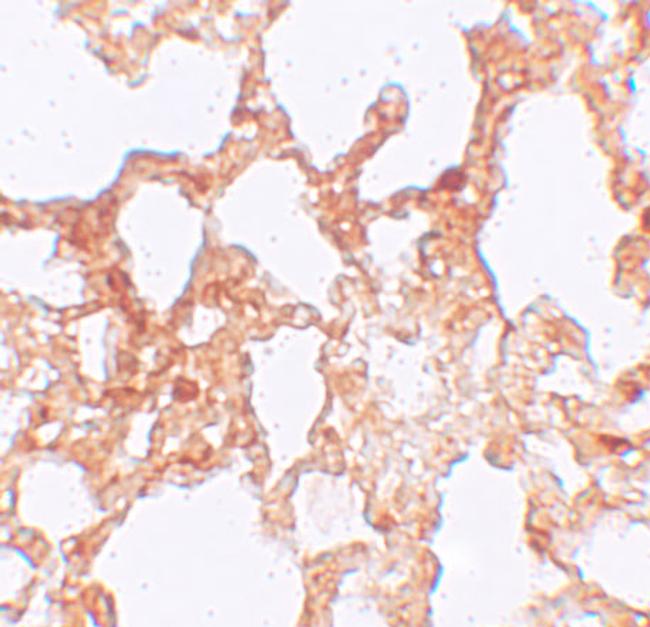 ZMYM1 Antibody in Immunohistochemistry (IHC)