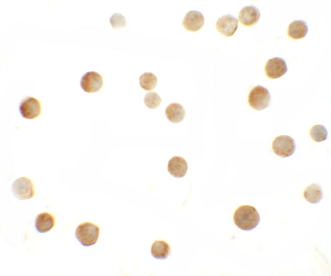 ZMYM2 Antibody in Immunocytochemistry (ICC/IF)