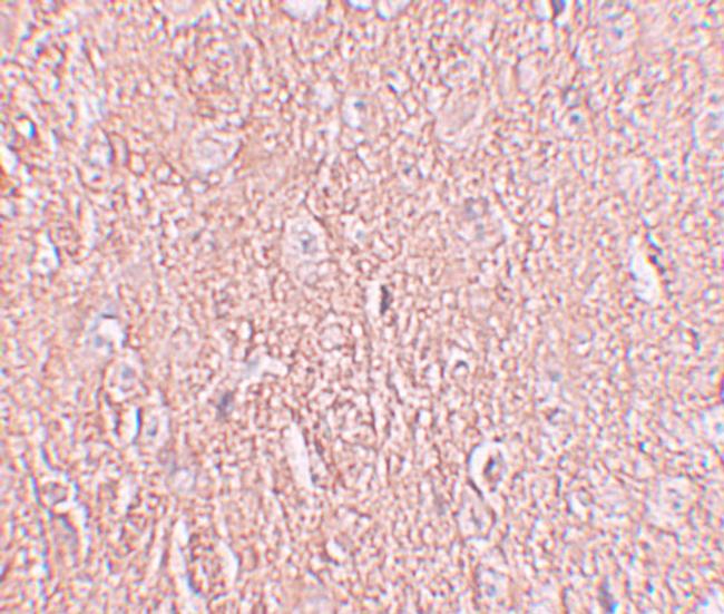 LRRTM2 Antibody in Immunohistochemistry (IHC)