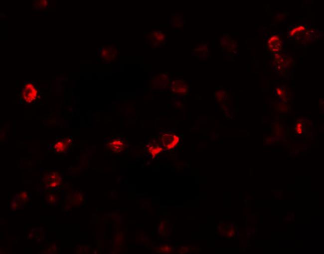 OGFOD1 Antibody in Immunocytochemistry (ICC/IF)