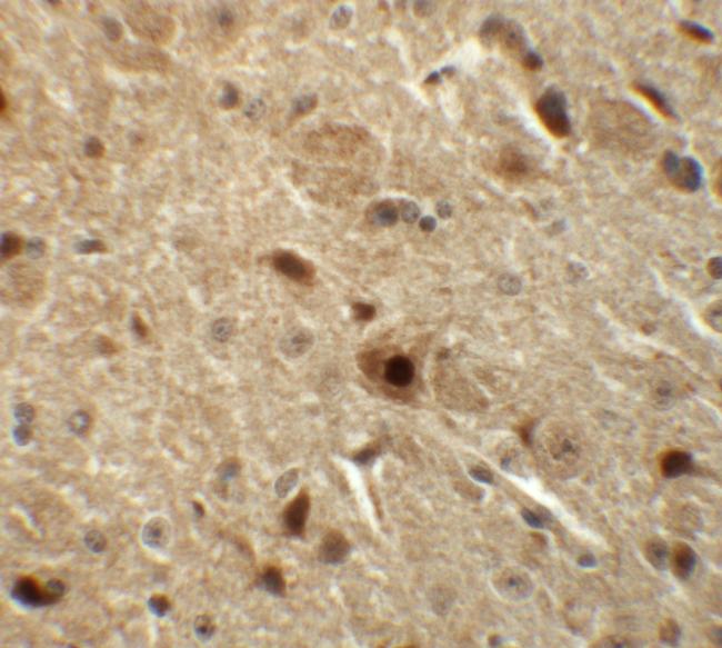 Nkx3.2 Antibody in Immunohistochemistry (IHC)