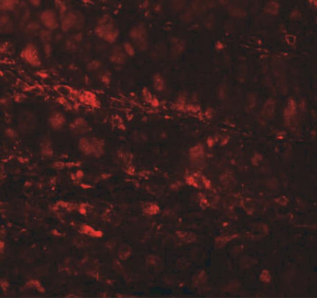 ESRP1 Antibody in Immunohistochemistry (IHC)