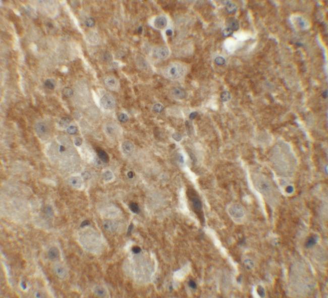 CTNNBL1 Antibody in Immunohistochemistry (IHC)