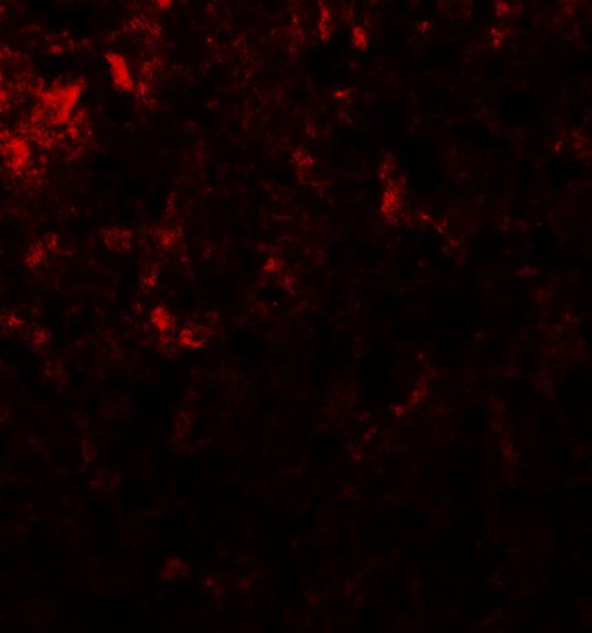 GLS2 Antibody in Immunocytochemistry (ICC/IF)